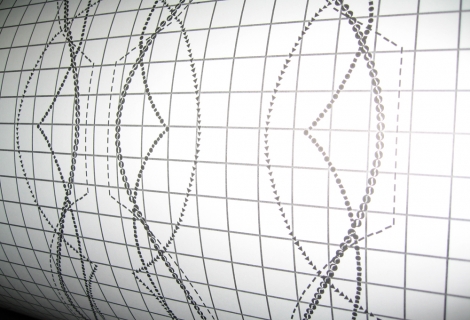 ASLAN_Schabrake_selbstklebend_Auschnitt_0